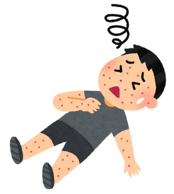sick_anaphylaxis.png